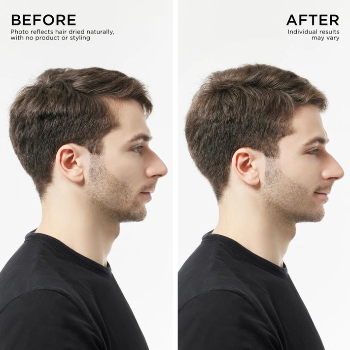 Before and After Results